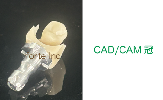CAD/CAM冠、PEEK冠 - 東京都千代田区で歯科技工を行う フォルテ株式会社